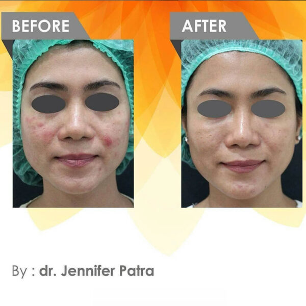 AQ Active Serum