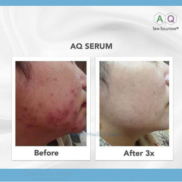 AQ Serum